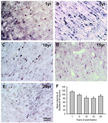 Differential effects of prolonged post-fixation on immunohistochemical and histochemical staining for postmortem human brains